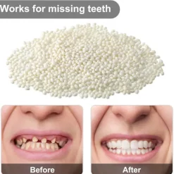 50 G Tandfast Tandgel Temporärt Reparationskit Formbar Termisk Passform Pärlor Tandgranulat Lim Falska Tänder För Halloween Läskigt (50g)> Tillbehör