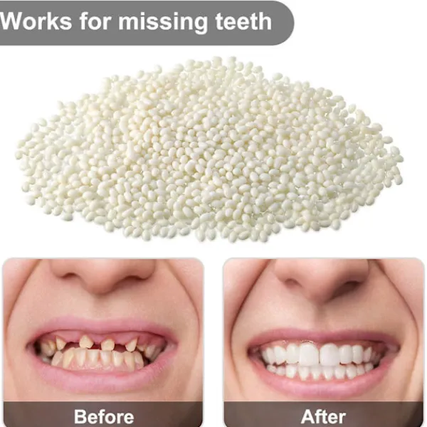 50 G Tandfast Tandgel Temporärt Reparationskit Formbar Termisk Passform Pärlor Tandgranulat Lim Falska Tänder För Halloween Läskigt (50g)> Tillbehör