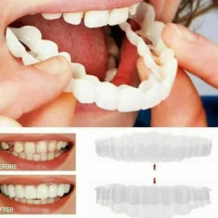1 st Smile Snap On Övre Falska Tand Fanér Proteser Falska Tänder Omslag Tw> Tillbehör
