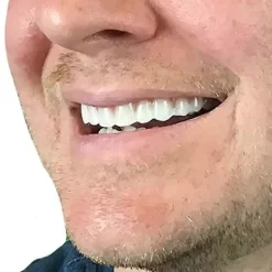 6 Stycken Omedelbara Fanérproteser Bekväma Övre Leendetänder Vita Kosmetiska Tänder Temporära Falska Tänder Komfort Passform Flex Tänder Tw><noscript><img width=