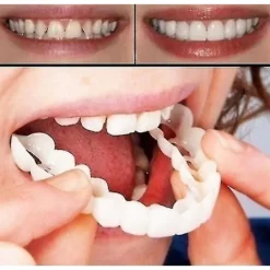 Ett par övre och nedre högkvalitativa proteser Omedelbart leende Komfort Passform Flex Kosmetiska tänder Tandprotes Tänder Topp kosmetisk faner Perfekt_max | Fyndiq> Tillbehör