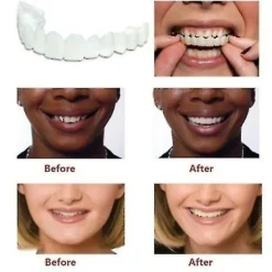 Ett par övre och nedre högkvalitativa proteser Omedelbart leende Komfort Passform Flex Kosmetiska tänder Tandprotes Tänder Topp kosmetisk faner Perfekt_max | Fyndiq><noscript><img width=