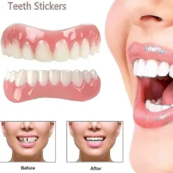 Extra Tunna Falska Ljusa Vita Tandfanér Silikon Mjuk Säker Lim Tandprotes Hölje Skugga Tandställning Bekväma Tänder Ortodonti> Tillbehör