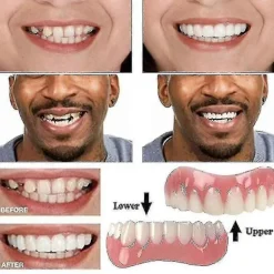 Extra Tunna Falska Ljusa Vita Tandfanér Silikon Mjuk Säker Lim Tandprotes Hölje Skugga Tandställning Bekväma Tänder Ortodonti><noscript><img width=