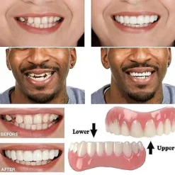 unbranded Extra tunna falska ljusa vita tandfanér i silikon, mjuka, säkra, självhäftande proteser, dölj skuggade tandställningar, bekväma tänder, ortodonti><noscript><img width=