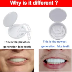 Falska tänder, tandproteser för över- och underkäke, Snap On V Y><noscript><img width=