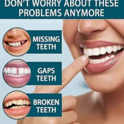 Löständer Temporära Falska Tänder För Omedelbart Självförtroende Leende, Tandfasader För Temporär Tandrestaureringa6><noscript><img width=