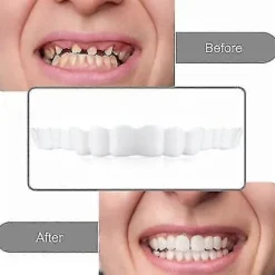 Smile Snap On Lösa Tänder Övre Nedre Tandfasader Proteser Tandskydd Set PTW> Tillbehör