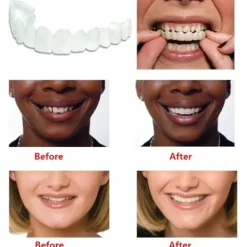 Snap On Tandfanér, Perfekta Tillfälliga Tandersättningar - Falska Fanérkit> Tillbehör