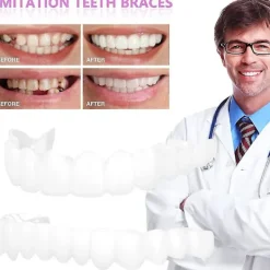 Snap On Tandfanér, Perfekta Tillfälliga Tandersättningar - Falska Fanérkit><noscript><img width=