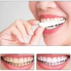 Snap On Tandfanér, Perfekta Tillfälliga Tandersättningar - Falska Fanérkit><noscript><img width=